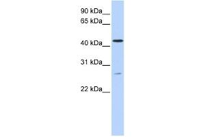 WB Suggested Anti-ACBD5 Antibody Titration:  0. (ACBD5 anticorps  (C-Term))
