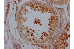 IHC image of ABIN7127809 diluted at 1:100 and staining in paraffin-embedded human testis tissue performed on a Leica BondTM system. (Recombinant SIRT1 anticorps)
