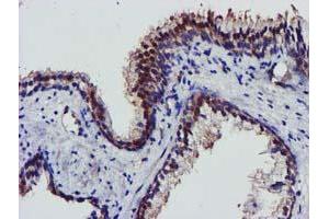 Image no. 5 for anti-V-Akt Murine Thymoma Viral Oncogene Homolog 1 (AKT1) antibody (ABIN1496559) (AKT1 anticorps)