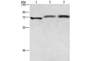 Western Blot analysis of Hela cell, Human fetal brain and hepatocellular carcinoma tissue using RDX Polyclonal Antibody at dilution of 1:700 (Radixin anticorps)