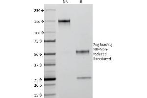 SDS-PAGE Analysis Purified Cytokeratin 18 Mouse Monoclonal Antibody (C-04).