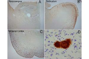 Extensive OC labeling was observed in the hippocampus (A), subiculum (B) and frontal cortex (C) in Alzheimer disease. (Amyloid Fibrils anticorps)