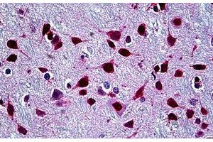 Human Brain, Cortex: Formalin-Fixed, Paraffin-Embedded (FFPE)