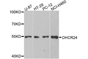 Western blot analysis of extracts of various cell lines, using DHCR24 antibody. (Seladin 1 anticorps  (AA 227-516))