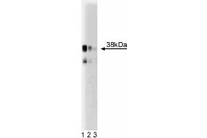 Western blot analysis of serine racemase in a mouse cerebrum lysate.