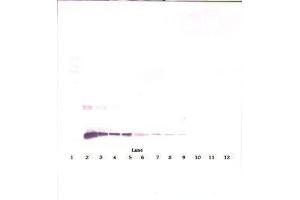 Image no. 1 for anti-Interleukin 10 (IL10) antibody (ABIN465277)