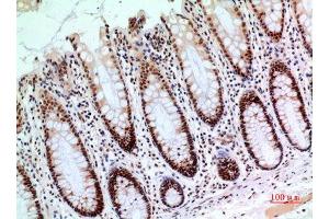 Immunohistochemistry (IHC) analysis of paraffin-embedded Human Colon, antibody was diluted at 1:100.