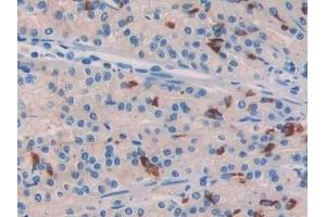 Detection of COL3a1 in Rat Stomach Tissue using Polyclonal Antibody to Collagen Type III Alpha 1 (COL3a1)