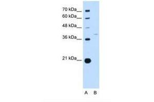 Image no. 1 for anti-Replication Factor C (Activator 1) 3, 38kDa (RFC3) (AA 91-140) antibody (ABIN6738211) (RFC3 anticorps  (AA 91-140))