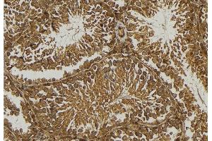 ABIN6276748 at 1/100 staining Mouse testis tissue by IHC-P. (BAD anticorps  (Internal Region))