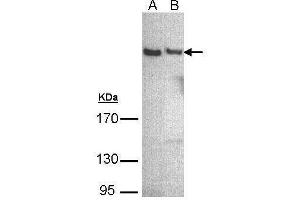WB Image Sample (30 ug of whole cell lysate) A: A431 , B: Hep G2 , 5% SDS PAGE antibody diluted at 1:500 (PLCH1 anticorps)