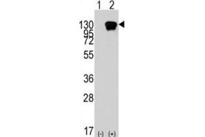 Western Blotting (WB) image for anti-Receptor Tyrosine Kinase-Like Orphan Receptor 1 (ROR1) antibody (ABIN2924492)