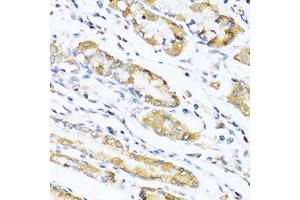 Immunohistochemistry of paraffin-embedded human stomach using LYZ antibody (ABIN5975352) at dilution of 1/100 (40x lens). (LYZ anticorps)
