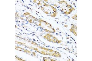 Immunohistochemistry of paraffin-embedded human stomach using LYZ antibody (ABIN5975352) at dilution of 1/100 (40x lens).