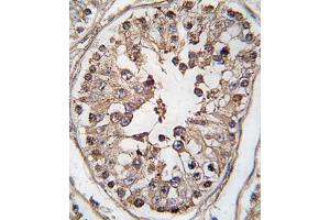 Immunohistochemistry (IHC) image for anti-TBK antibody (ABIN3003556) (TBK anticorps)