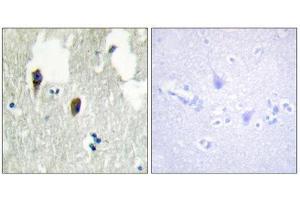 Immunohistochemistry (IHC) image for anti-Kelch-Like 3 (KLHL3) (N-Term) antibody (ABIN1850052) (KLHL3 anticorps  (N-Term))