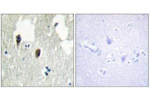 Immunohistochemistry (IHC) image for anti-Kelch-Like 3 (KLHL3) (N-Term) antibody (ABIN1850052) (KLHL3 anticorps  (N-Term))