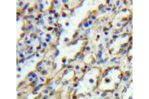 Used in DAB staining on fromalin fixed paraffin-embedded spleen tissue (IL5RA anticorps  (AA 41-203))