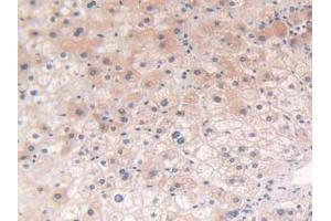 IHC-P analysis of Human Liver Tissue, with DAB staining. (POR anticorps  (AA 77-518))