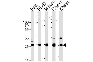 DANRE sdhb Antibody Azb10040a western blot analysis in Hela,HL-60 cell line,mouse heart,rat heart,zebra fish heart tissue lysates (35 μg/lane).