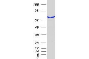 Validation with Western Blot
