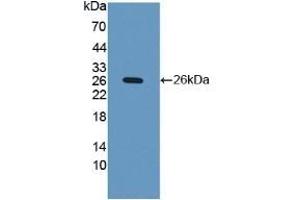Detection of Recombinant iNV, Human using Polyclonal Antibody to Involucrin (INV)