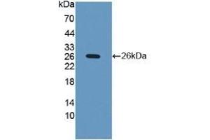 Detection of Recombinant iNV, Human using Polyclonal Antibody to Involucrin (INV) (Involucrin anticorps  (AA 36-152))