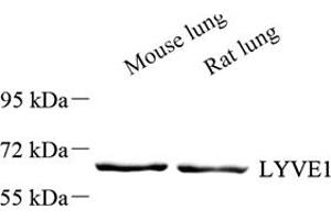 Western blot analysis of LYVE1 (ABIN7074522),at dilution of 1: 1000 (LYVE1 anticorps)