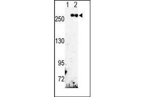Western blot analysis of FASN (arrow) using rabbit polyclonal FASN Antibody (Fatty Acid Synthase anticorps  (Middle Region))