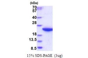 SDS-PAGE (SDS) image for Calpain, Small Subunit 1 (CAPNS1) (AA 84-268) protein (His tag) (ABIN5853704)