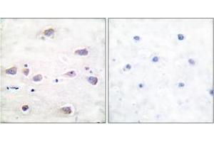 Immunohistochemistry analysis of paraffin-embedded human brain, using NMDAR1 (Phospho-Ser897) Antibody. (GRIN1/NMDAR1 anticorps  (pSer897))