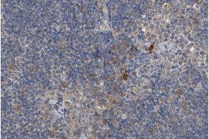 ABIN6266462 at 1/200 staining human lymph node tissue sections by IHC-P.