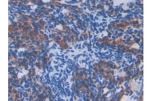 Detection of IL13Ra2 in Mouse Ovary Tissue using Polyclonal Antibody to Interleukin 13 Receptor Alpha 2 (IL13Ra2)