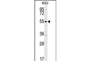 TSPYL4 Antibody (N-term) (ABIN652012 and ABIN2840495) western blot analysis in WiDr cell line lysates (35 μg/lane). (TSPY-Like 4 anticorps  (N-Term))