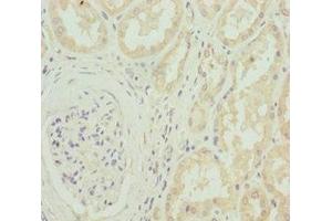 Immunohistochemistry of paraffin-embedded human kidney tissue using ABIN7175594 at dilution of 1:100 (CACNB1 anticorps  (AA 429-598))