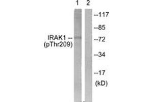 Western blot analysis of extracts from HeLa cells, using IRAK1 (Phospho-Thr209) Antibody. (IRAK1 anticorps  (pThr209))