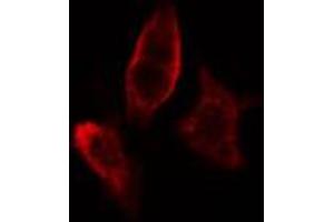 ABIN6267611 staining HeLa cells by IF/ICC.