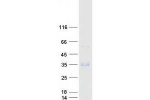 Validation with Western Blot