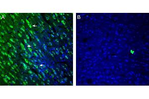 Expression of 5HT2A Receptor in rat cingulate cortex. (HTR2A anticorps  (Extracellular, N-Term))