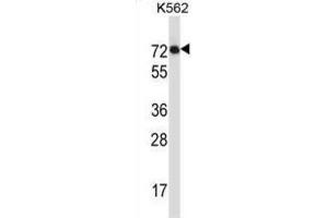 Western Blotting (WB) image for anti-Interleukin 1 Receptor-Like 2 (IL1RL2) antibody (ABIN2997308) (IL1RL2 anticorps)