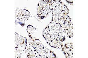 Immunohistochemistry of paraffin-embedded human placenta using TBX20 Rabbit pAb (ABIN7270698) at dilution of 1:100 (40x lens). (TBX20 anticorps  (AA 1-290))