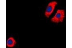 Immunofluorescent analysis of CYSLTR1 staining in Jurkat cells.