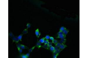 Immunofluorescent analysis of 293 cells using ABIN7170098 at dilution of 1:100 and Alexa Fluor 488-congugated AffiniPure Goat Anti-Rabbit IgG(H+L)