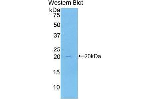 Detection of Recombinant CDKN2A, Human using Polyclonal Antibody to Cyclin Dependent Kinase Inhibitor 2A (CDKN2A)