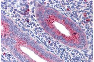 Uterus: Formalin-Fixed, Paraffin-Embedded (FFPE)