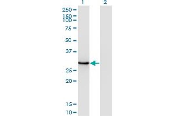 DLX1 anticorps  (AA 181-254)