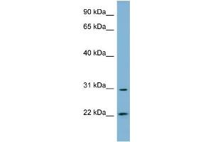 WB Suggested Anti-HSD17B14 Antibody Titration: 0. (HSD17B14 anticorps  (N-Term))