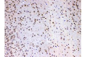 IHC analysis of MED4 using anti-MED4 antibody .