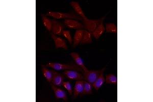 Immunofluorescence analysis of NIH/3T3 cells using GRP Rabbit pAb (ABIN6127573, ABIN6141433, ABIN6141434 and ABIN6222002) at dilution of 1:50 (40x lens).