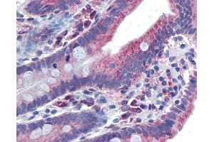 Anti-PXR antibody IHC of human small intestine.